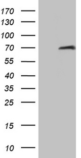 HABP2 Antibody - HEK293T cells were transfected with the pCMV6-ENTRY control. (Left lane) or pCMV6-ENTRY FLJ40504. (Right lane) cDNA for 48 hrs and lysed. Equivalent amounts of cell lysates. (5 ug per lane) were separated by SDS-PAGE and immunoblotted with anti-HABP2 antibody. (1:2000)