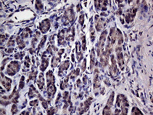 HABP2 Antibody - Immunohistochemical staining of paraffin-embedded Human pancreas tissue within the normal limits using anti-HABP2 mouse monoclonal antibody. (Heat-induced epitope retrieval by 1mM EDTA in 10mM Tris buffer. (pH8.5) at 120°C for 3 min. (1:1000)
