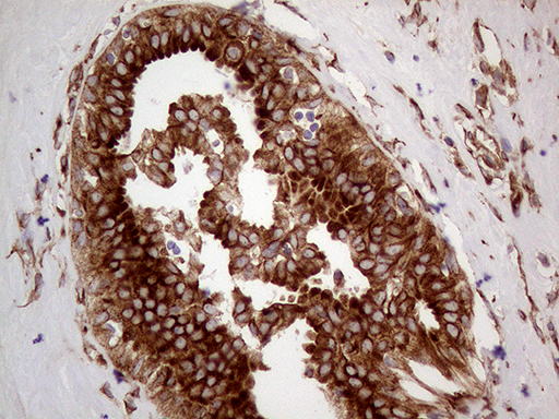 HABP2 Antibody - Immunohistochemical staining of paraffin-embedded Human breast tissue within the normal limits using anti-HABP2 mouse monoclonal antibody. (Heat-induced epitope retrieval by 1mM EDTA in 10mM Tris buffer. (pH8.5) at 120°C for 3 min. (1:2000)