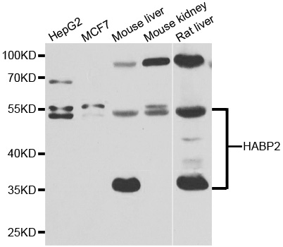 HABP2 Antibody - Western blot analysis of extracts of various cell lines.