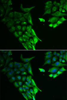 HABP2 Antibody - Immunofluorescence analysis of A549 cells.
