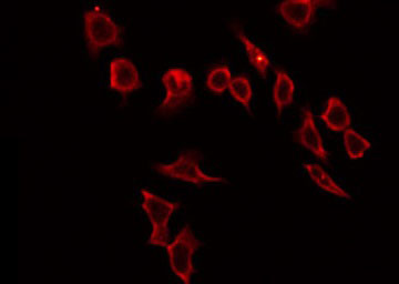 HABP2 Antibody - Staining HeLa cells by IF/ICC. The samples were fixed with PFA and permeabilized in 0.1% Triton X-100, then blocked in 10% serum for 45 min at 25°C. The primary antibody was diluted at 1:200 and incubated with the sample for 1 hour at 37°C. An Alexa Fluor 594 conjugated goat anti-rabbit IgG (H+L) Ab, diluted at 1/600, was used as the secondary antibody.