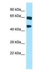 HABP4 Antibody - HABP4 antibody Western Blot of 721_B.  This image was taken for the unconjugated form of this product. Other forms have not been tested.