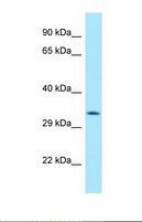 HABP4 Antibody - Western blot of Human HepG2. HABP4 antibody dilution 1.0 ug/ml.  This image was taken for the unconjugated form of this product. Other forms have not been tested.
