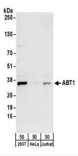 HABT1 / ABT1 Antibody - Detection of Human ABT1 by Western Blot. Samples: Whole cell lysate (50 ug) from 293T, HeLa, and Jurkat cells. Antibodies: Affinity purified rabbit anti-ABT1 antibody used for WB at 0.1 ug/ml. Detection: Chemiluminescence with an exposure time of 30 seconds.