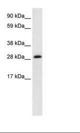 HABT1 / ABT1 Antibody - Fetal Heart Lysate.  This image was taken for the unconjugated form of this product. Other forms have not been tested.