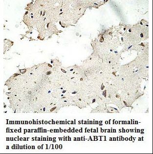 HABT1 / ABT1 Antibody
