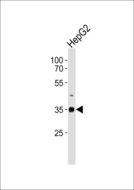 HABT1 / ABT1 Antibody - Western blot of lysate from HepG2 cell line with ABT1 Antibody. Antibody was diluted at 1:1000. A goat anti-rabbit IgG H&L (HRP) at 1:10000 dilution was used as the secondary antibody. Lysate at 20 ug.