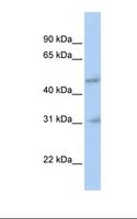 HABT1 / ABT1 Antibody - 721_B cell lysate. Antibody concentration: 1.0 ug/ml. Gel concentration: 12%.  This image was taken for the unconjugated form of this product. Other forms have not been tested.
