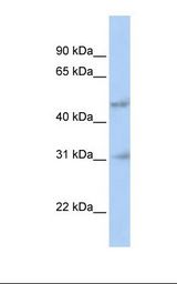 HABT1 / ABT1 Antibody - 721_B cell lysate. Antibody concentration: 1.0 ug/ml. Gel concentration: 12%.  This image was taken for the unconjugated form of this product. Other forms have not been tested.
