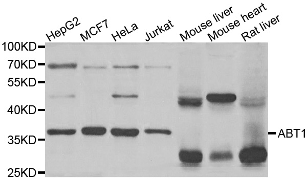 HABT1 / ABT1 Antibody - Western blot analysis of extracts of various cell lines.