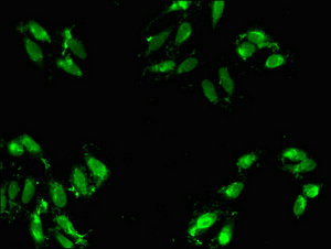 HABT1 / ABT1 Antibody - Immunofluorescent analysis of Hela cells a at a dilution of 1:100 and Alexa Fluor 488-congugated AffiniPure Goat Anti-Rabbit IgG(H+L)