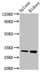 HABT1 / ABT1 Antibody - Positive Western Blot detected in Mouse spleen tissue, Mouse kidney tissue. All lanes: ABT1 antibody at 3 µg/ml Secondary Goat polyclonal to rabbit IgG at 1/50000 dilution. Predicted band size: 32 KDa. Observed band size: 32 KDa