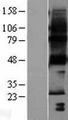 HACD1 / PTPLA Protein - Western validation with an anti-DDK antibody * L: Control HEK293 lysate R: Over-expression lysate