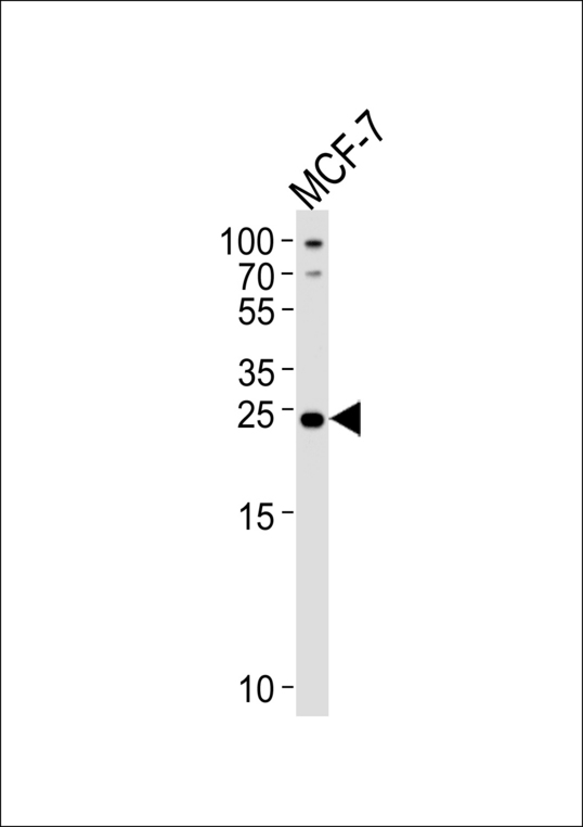 HACD2 / PTPLB Antibody - Western blot of lysate from MCF-7 cell line, using PTPLB Antibody. Antibody was diluted at 1:1000 at each lane. A goat anti-rabbit IgG H&L (HRP) at 1:5000 dilution was used as the secondary antibody. Lysate at 35ug per lane.