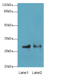 HACD2 / PTPLB Antibody - Western blot. All lanes: HACD2 antibody at 4 ug/ml. Lane 1: MCF7 whole cell lysate. Lane 2: LO2 whole cell lysate. Secondary Goat polyclonal to Rabbit IgG at 1:10000 dilution. Predicted band size: 28 kDa. Observed band size: 28 kDa.