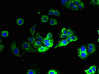 HACD2 / PTPLB Antibody - Immunofluorescent analysis of MCF-7 cells using HACD2 Antibody at dilution of 1:100 and Alexa Fluor 488-congugated AffiniPure Goat Anti-Rabbit IgG(H+L)