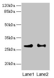 HACD2 / PTPLB Antibody - Western blot All lanes: HACD2 antibody at 4µg/ml Lane 1: MCF-7 whole cell lysate Lane 2: LO2 whole cell lysate Secondary Goat polyclonal to rabbit IgG at 1/10000 dilution Predicted band size: 28 kDa Observed band size: 28 kDa