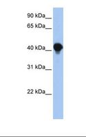 HACD3 / PTPLAD1 Antibody - Fetal muscle lysate. Antibody concentration: 1.0 ug/ml. Gel concentration: 12%.  This image was taken for the unconjugated form of this product. Other forms have not been tested.