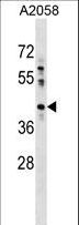 HACD3 / PTPLAD1 Antibody - PTPLAD1 Antibody western blot of A2058 cell line lysates (35 ug/lane). The PTPLAD1 antibody detected the PTPLAD1 protein (arrow).