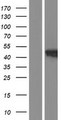 HACD3 / PTPLAD1 Protein - Western validation with an anti-DDK antibody * L: Control HEK293 lysate R: Over-expression lysate