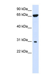 HACD4 / PTPLAD2 Antibody - PTPLAD2 antibody Western blot of 293T cell lysate. This image was taken for the unconjugated form of this product. Other forms have not been tested.