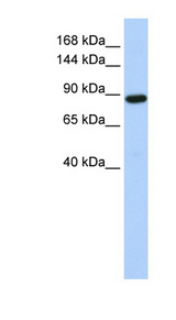 HACE1 Antibody - HACE1 antibody Western blot of HeLa lysate. This image was taken for the unconjugated form of this product. Other forms have not been tested.