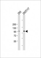 HACE1 Antibody - All lanes: Anti-HACE1 Antibody at 1:2000 dilution Lane 1: 293 whole cell lysate Lane 2: 293T/17 whole cell lysate e Lysates/proteins at 20 µg per lane. Secondary Goat Anti-mouse IgG, (H+L), Peroxidase conjugated at 1/10000 dilution. Predicted band size: 102 kDa Blocking/Dilution buffer: 5% NFDM/TBST.