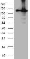 HACE1 Antibody - HEK293T cells were transfected with the pCMV6-ENTRY control. (Left lane) or pCMV6-ENTRY HACE1. (Right lane) cDNA for 48 hrs and lysed. Equivalent amounts of cell lysates. (5 ug per lane) were separated by SDS-PAGE and immunoblotted with anti-HACE1. (1:2000)