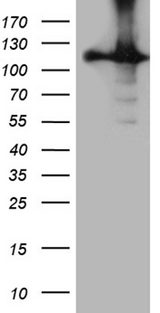 HACE1 Antibody - HEK293T cells were transfected with the pCMV6-ENTRY control. (Left lane) or pCMV6-ENTRY HACE1. (Right lane) cDNA for 48 hrs and lysed