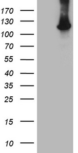 HACE1 Antibody - HEK293T cells were transfected with the pCMV6-ENTRY control. (Left lane) or pCMV6-ENTRY HACE1. (Right lane) cDNA for 48 hrs and lysed. Equivalent amounts of cell lysates. (5 ug per lane) were separated by SDS-PAGE and immunoblotted with anti-HACE1. (1:2000)