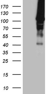 HACE1 Antibody - HEK293T cells were transfected with the pCMV6-ENTRY control. (Left lane) or pCMV6-ENTRY HACE1. (Right lane) cDNA for 48 hrs and lysed. Equivalent amounts of cell lysates. (5 ug per lane) were separated by SDS-PAGE and immunoblotted with anti-HACE1. (1:500)