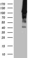 HACE1 Antibody - HEK293T cells were transfected with the pCMV6-ENTRY control. (Left lane) or pCMV6-ENTRY HACE1. (Right lane) cDNA for 48 hrs and lysed