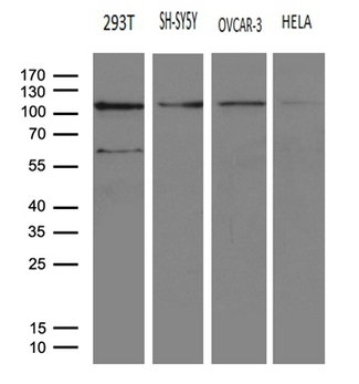 HACE1 Antibody - Western blot analysis of extracts. (35ug) from 4 different cell lines by using anti-HACE1 monoclonal antibody. (1:500)