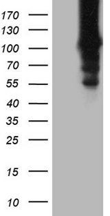 HACE1 Antibody - HEK293T cells were transfected with the pCMV6-ENTRY control. (Left lane) or pCMV6-ENTRY HACE1. (Right lane) cDNA for 48 hrs and lysed