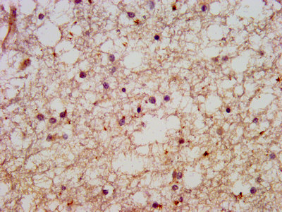 HACE1 Antibody - Immunohistochemistry image at a dilution of 1:600 and staining in paraffin-embedded human brain tissue performed on a Leica BondTM system. After dewaxing and hydration, antigen retrieval was mediated by high pressure in a citrate buffer (pH 6.0) . Section was blocked with 10% normal goat serum 30min at RT. Then primary antibody (1% BSA) was incubated at 4 °C overnight. The primary is detected by a biotinylated secondary antibody and visualized using an HRP conjugated SP system.