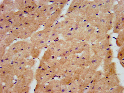 HACE1 Antibody - Immunohistochemistry image at a dilution of 1:600 and staining in paraffin-embedded human heart tissue performed on a Leica BondTM system. After dewaxing and hydration, antigen retrieval was mediated by high pressure in a citrate buffer (pH 6.0) . Section was blocked with 10% normal goat serum 30min at RT. Then primary antibody (1% BSA) was incubated at 4 °C overnight. The primary is detected by a biotinylated secondary antibody and visualized using an HRP conjugated SP system.