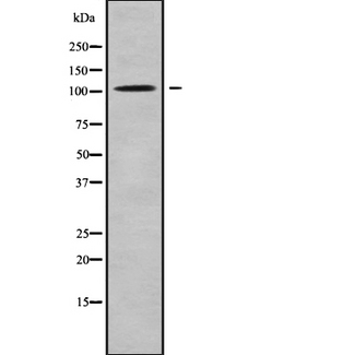 HACE1 Antibody - Western blot analysis of HACE1 using LOVO cells whole cells lysates