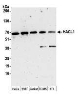 HACL1 Antibody - Detection of human and mouse HACL1 by western blot. Samples: Whole cell lysate (15 µg) from HeLa, HEK293T, Jurkat, mouse TCMK-1, and mouse NIH 3T3 cells prepared using NETN lysis buffer. Antibody: Affinity purified rabbit anti-HACL1 antibody used for WB at 1:1000. Detection: Chemiluminescence with an exposure time of 3 minutes.