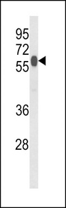 HACL1 Antibody - Western blot of PHYH2 Antibody in mouse liver tissue lysates (35 ug/lane). PHYH2 (arrow) was detected using the purified antibody.