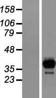 HACL1 Protein - Western validation with an anti-DDK antibody * L: Control HEK293 lysate R: Over-expression lysate