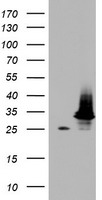 HADH Antibody - HEK293T cells were transfected with the pCMV6-ENTRY control (Left lane) or pCMV6-ENTRY HADH (Right lane) cDNA for 48 hrs and lysed. Equivalent amounts of cell lysates (5 ug per lane) were separated by SDS-PAGE and immunoblotted with anti-HADH.