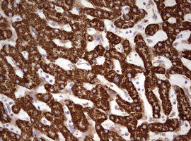 HADH Antibody - IHC of paraffin-embedded Human liver tissue using anti-HADH mouse monoclonal antibody. (Heat-induced epitope retrieval by 10mM citric buffer, pH6.0, 120°C for 3min).