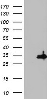 HADH Antibody - HEK293T cells were transfected with the pCMV6-ENTRY control (Left lane) or pCMV6-ENTRY HADH (Right lane) cDNA for 48 hrs and lysed. Equivalent amounts of cell lysates (5 ug per lane) were separated by SDS-PAGE and immunoblotted with anti-HADH.