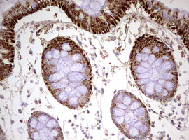HADH Antibody - IHC of paraffin-embedded Human colon tissue using anti-HADH mouse monoclonal antibody. (Heat-induced epitope retrieval by 10mM citric buffer, pH6.0, 120°C for 3min).