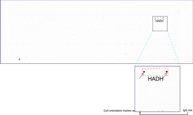 HADH Antibody - OriGene overexpression protein microarray chip was immunostained with UltraMAB anti-HADH mouse monoclonal antibody. The positive reactive proteins are highlighted with two red arrows in the enlarged subarray. All the positive controls spotted in this subarray are also labeled for clarification.