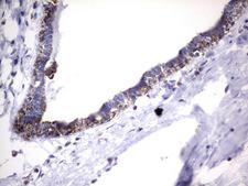 HADH Antibody - Immunohistochemical staining of paraffin-embedded Human breast tissue using anti-HADH mouse monoclonal antibody.  heat-induced epitope retrieval by 10mM citric buffer, pH6.0, 120C for 3min)