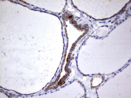 HADH Antibody - Immunohistochemical staining of paraffin-embedded Human thyroid tissue using anti-HADH mouse monoclonal antibody.  heat-induced epitope retrieval by 10mM citric buffer, pH6.0, 120C for 3min)