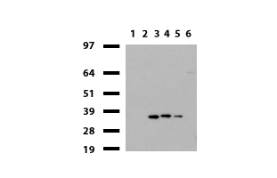 HADH Antibody - Western blot of mouse tissue lysates. (20ug) from 6 different tissues. (1: Uterus, 2: Brain, 3: Liver, 4: Ovary, 5: Colon, 6: Spleen ). Primary antibody diluation: 1:500. Secondary antibody dilution: Mouse TrueBlot® Ultra. (1:1000).