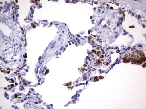 HADH Antibody - Immunohistochemical staining of paraffin-embedded Human lung tissue using anti-HADH mouse monoclonal antibody.  heat-induced epitope retrieval by 10mM citric buffer, pH6.0, 120C for 3min)